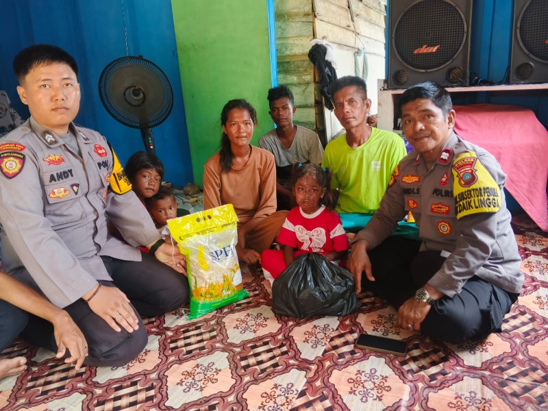 Polsek Daik Lingga Sambangi Aurel, Bocah 6 Tahun Korban Tumpahan Minyak Panas di Penuba.
