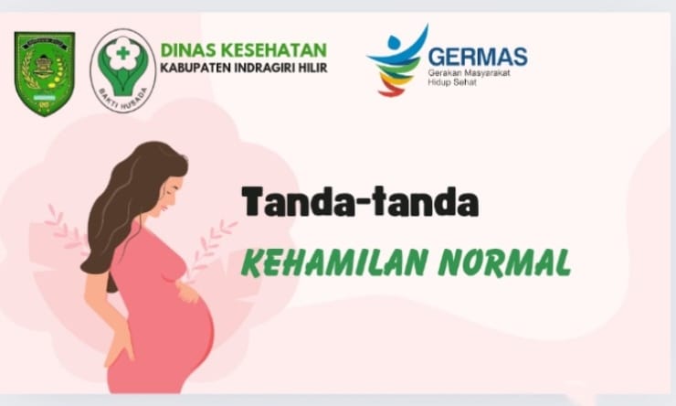 Ibu Harus Tau, ini Tanda-tanda Kehamilan Normal